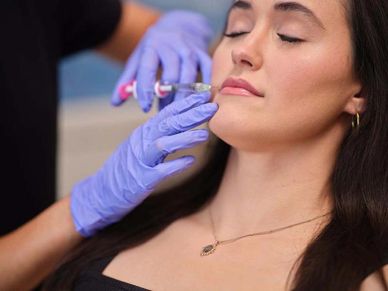 Azure--July22-202430981 woman getting filler injection in lip