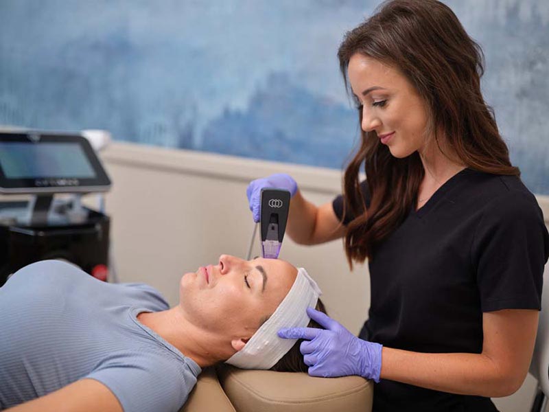 Azure--July22-202431089 microneedling treatment